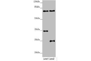 Western blot All lanes: NEDD1 antibody at 3. (NEDD1 Antikörper  (AA 411-660))