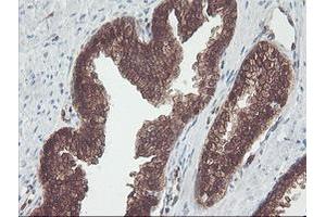 Image no. 2 for anti-CNDP Dipeptidase 2 (Metallopeptidase M20 Family) (CNDP2) antibody (ABIN1497548) (CNDP2 Antikörper)