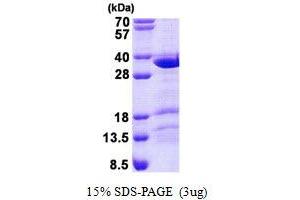 Image no. 1 for Coiled-Coil Domain Containing 43 (CCDC43) (AA 1-224) protein (His tag) (ABIN1098568)