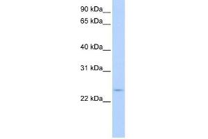 CIP29 antibody used at 0. (SARNP Antikörper  (C-Term))