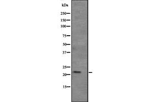 Western blot analysis of APR3 expression in human kidney tissue lysate ,The lane on the left is treated with the antigen-specific peptide. (ATRAID Antikörper  (Internal Region))