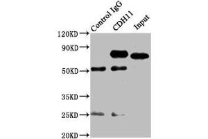 Immunoprecipitating CDH11 in SH-SY5Y whole cell lysate Lane 1: Rabbit control IgG instead of ABIN7146201 in SH-SY5Y whole cell lysate. (OB Cadherin Antikörper  (AA 637-796))