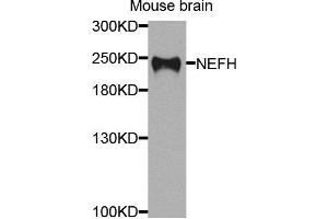 Western blot analysis of extracts of mouse brain cells, using NEFH antibody. (NEFH Antikörper)