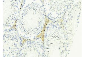 ABIN6274688 at 1/100 staining Mouse testis tissue by IHC-P. (LAMa4 Antikörper  (Internal Region))