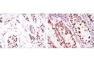 Immunohistochemistry (IHC) image for anti-Protein Kinase, DNA-Activated, Catalytic Polypeptide (PRKDC) antibody (ABIN969366)