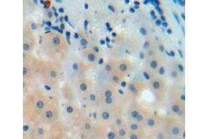 IHC-P analysis of liver tissue, with DAB staining. (C9 Antikörper  (AA 136-512))