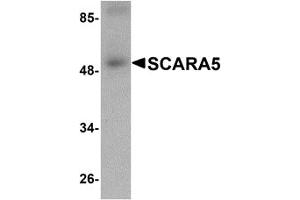 Western Blotting (WB) image for anti-Scavenger Receptor Class A, Member 5 (SCARA5) (C-Term) antibody (ABIN1030645)