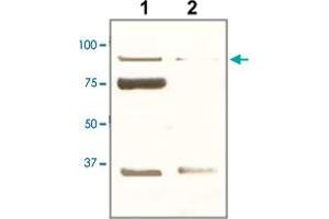 The tissue lysate derived from mouse kidney was immunoprobed by POU2F1 polyclonal antibody  at 1 : 500. (POU2F1 Antikörper  (C-Term))