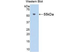 Western Blotting (WB) image for anti-Angiotensinogen (serpin Peptidase Inhibitor, Clade A, Member 8) (AGT) (AA 25-477) antibody (ABIN1857948) (AGT Antikörper  (AA 25-477))