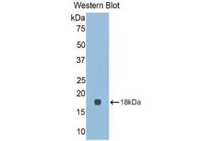 Western blot analysis of the recombinant protein. (LGALS9C Antikörper  (AA 17-148))