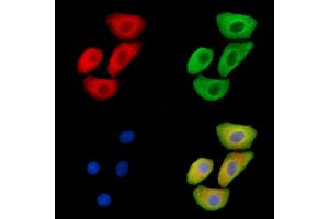 ABIN6265590 and ABIN6279872 staining Hela cells by IF/ICC. (TJP3 Antikörper  (C-Term))