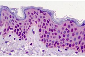 Human Skin: Formalin-Fixed, Paraffin-Embedded (FFPE) (POLR3F Antikörper  (N-Term))
