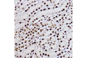 Immunohistochemistry (IHC) image for anti-C-terminal Binding Protein 2 (CTBP2) antibody (ABIN7265979)