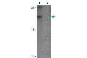 Western blot analysis of YPEL3 in A-20 cell lysate with YPEL3 polyclonal antibody  at 1 ug/mL in (lane 1) the absence and (lane 2) the presence of blocking peptide. (YPEL3 Antikörper  (N-Term))