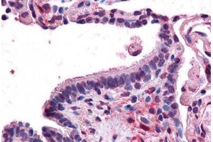Human Lung, Respiratory Epithelium: Formalin-Fixed, Paraffin-Embedded (FFPE) (MFI2 Antikörper  (N-Term))