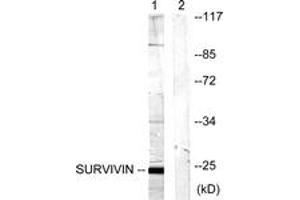 Western blot analysis of extracts from mouse lung cells, using Survivin (Ab-117) Antibody. (Survivin Antikörper  (AA 86-135))