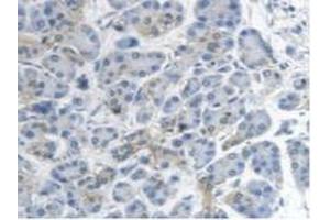 Detection of MTUS1 in Human Pancreas Tissue using Polyclonal Antibody to Mitochondrial Tumor Suppressor 1 (MTUS1) (MTUS1 Antikörper  (AA 1018-1270))
