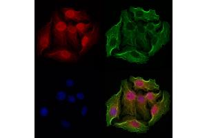 ABIN6263746 and ABIN6272947 staining Hela cells by IF/ICC. (NSUN2 Antikörper  (Internal Region))