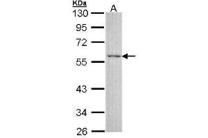 WB Image Sample (30 ug of whole cell lysate) A: A431 , 10% SDS PAGE antibody diluted at 1:3000 (ESRRG Antikörper)