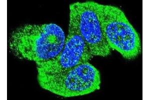 Immunofluorescence (IF) image for anti-HRas proto-oncogene, GTPase (HRAS) antibody (ABIN2996311) (HRAS Antikörper)