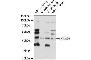 Western Blotting (WB) image for anti-Potassium Voltage-Gated Channel, Shaker-Related Subfamily, beta Member 3 (KCNAB3) (AA 285-404) antibody (ABIN7269482)