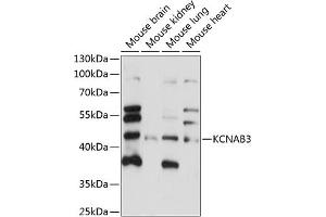 Western blot analysis of extracts of various cell lines, using KCN antibody (ABIN7269482) at 1:1000 dilution. (KCNAB3 Antikörper  (AA 285-404))