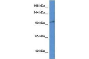anti-Zinc Finger CCCH-Type Containing 3 (ZC3H3) (N-Term) antibody