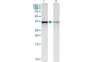 Western Blot analysis of PHC2 expression in transfected 293T cell line by PHC2 monoclonal antibody (M01), clone 1F4. (PHC2 Antikörper  (AA 91-200))
