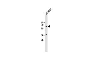 Anti-TXK Antibody (N-term) at 1:2000 dilution + U266B1 whole cell lysate Lysates/proteins at 20 μg per lane. (TXK Antikörper  (N-Term))