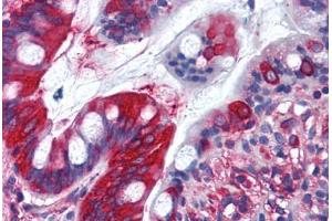 Human Small Intestine (formalin-fixed, paraffin-embedded) stained with TFG antibody ABIN290224 at 10 ug/ml followed by biotinylated goat anti-rabbit IgG secondary antibody ABIN481713, alkaline phosphatase-streptavidin and chromogen. (TFG Antikörper  (AA 350-400))
