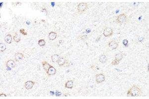 Immunohistochemistry of paraffin-embedded Rat brain using RNF149 Polyclonal Antibody at dilution of 1:100 (40x lens). (RNF149 Antikörper)