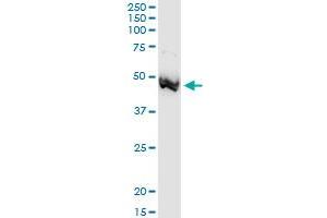 Immunoprecipitation (IP) image for anti-Adenosine Deaminase (ADA) (AA 1-363) antibody (ABIN513110)