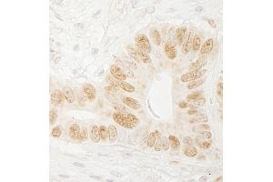 anti-CTF18, Chromosome Transmission Fidelity Factor 18 Homolog (CHTF18) (AA 25-75) antibody