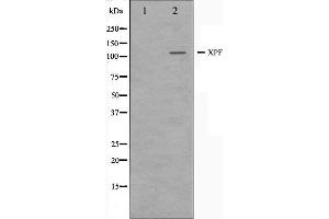 Western blot analysis on 293 cell lysate using XPF Antibody. (ERCC4 Antikörper  (C-Term))