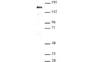 Western Blot: Nuclear extract of Saos-2 cells (20 µg per lane) probed with the SIP1 antibody (mAb) at a dilution of 1 µg/ml.