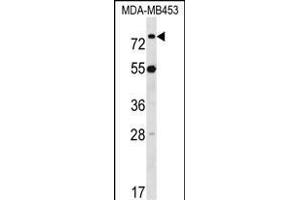 LDB3 Antibody (Center) (ABIN1538145 and ABIN2848672) western blot analysis in MDA-M cell line lysates (35 μg/lane). (LIM Domain Binding 3 Protein Antikörper  (AA 235-262))