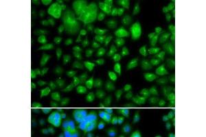 Immunofluorescence analysis of A549 cells using METTL7B Polyclonal Antibody (METTL7B Antikörper)