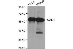 Western Blotting (WB) image for anti-Calreticulin (CALR) antibody (ABIN3021344) (Calreticulin Antikörper)