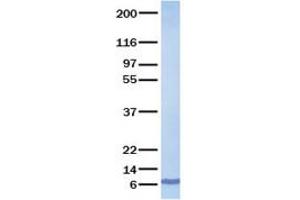 Validation with Western Blot (CCL27 Protein)