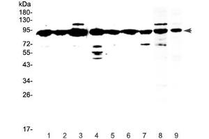 Western blot testing of human 1) HeLa, 2) placenta, 3) MCF7, 4) HepG2, 5) A549, 6) SKOV3, 7) PANC-1 and 8) mouse testis and 9) rat testis lysate with XRCC1 antibody at 0. (XRCC1 Antikörper)
