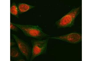 IF analysis of RAB3GAP1 using anti-RAB3GAP1 antibody (ABIN7599702) and Anti-Beta Tubulin Antibody (ABIN7602743). (RAB3GAP1 Antikörper  (AA 109-810))