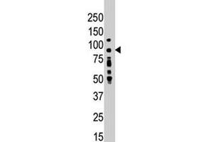 Western blot analysis of PRKCD polyclonal antibody  in placenta lysate . (PKC delta Antikörper  (N-Term))