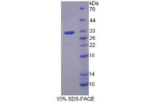 SDS-PAGE analysis of Human GNb3 Protein. (GNB3 Protein)
