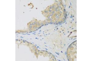 Immunohistochemistry of paraffin-embedded human prostate using LLGL2 antibody at dilution of 1:200 (40x lens). (LLGL2 Antikörper)