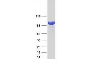Western Blotting (WB) image for TBC1 Domain Family, Member 25 (TBC1D25) protein (Myc-DYKDDDDK Tag) (ABIN2733273)