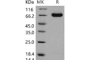 Western Blotting (WB) image for delta-Like 4 (DLL4) (Active) protein (His tag) (ABIN7320207) (DLL4 Protein (His tag))