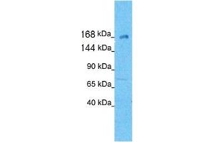 Western Blotting (WB) image for anti-Kinesin Family Member 21A (KIF21A) (N-Term) antibody (ABIN2778198) (KIF21A Antikörper  (N-Term))