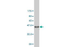 Western Blot detection against Immunogen (36. (Exportin 2 Antikörper  (AA 872-971))