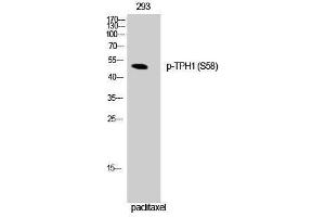 Western Blotting (WB) image for anti-Tryptophan Hydroxylase 1 (TPH1) (pSer58) antibody (ABIN3182629) (Tryptophan Hydroxylase 1 Antikörper  (pSer58))
