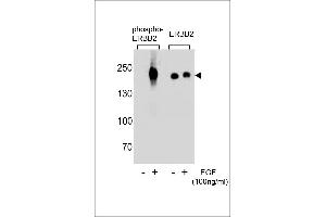 Western blot analysis of extracts from A431 cells,untreated or treated with EGF,100 ng/mL , using phospho-ERBB2-p(L)(left) or ERBB2 Antibody (right) (ErbB2/Her2 Antikörper  (pTyr1248))
